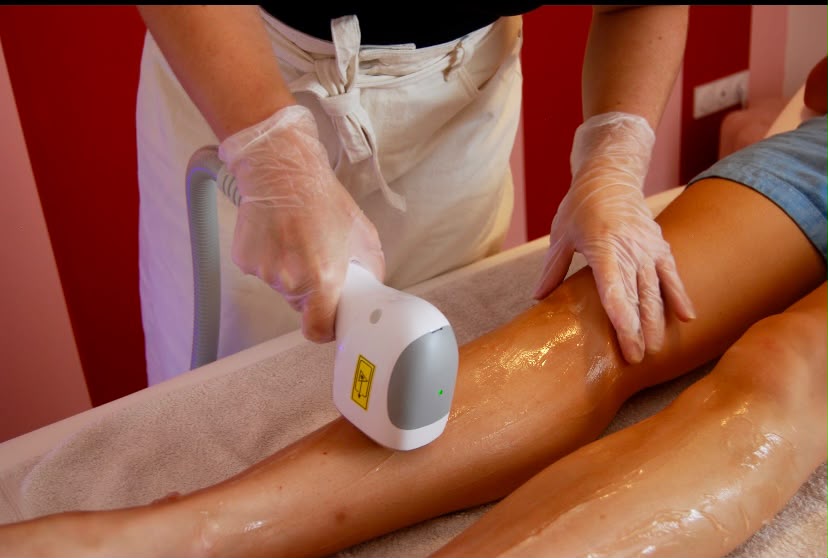 Séance d’épilation laser sur la jambe à Arthès