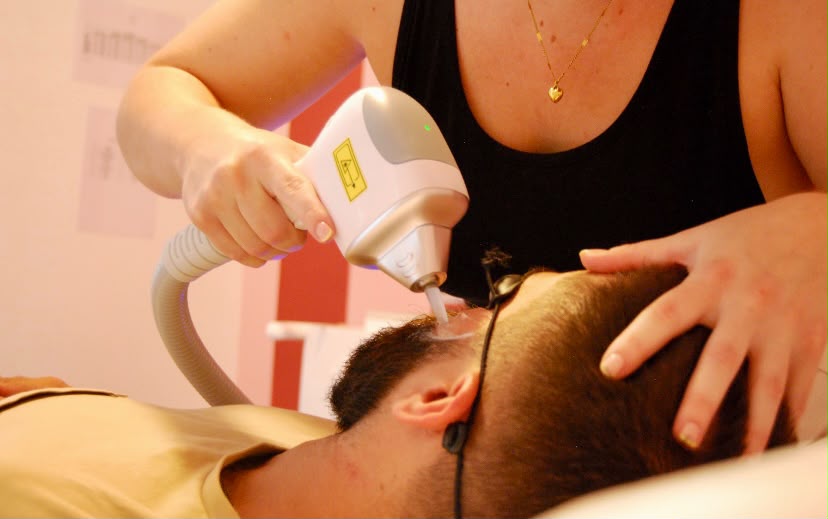 Épilation laser visage homme au centre MaryEdith