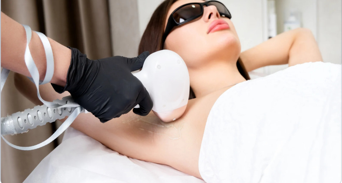 Épilation laser femme à Arthès – zones & tarifs